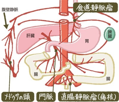 側副血行路のメカニズム説明図