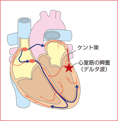 ケント束と電気的興奮説明図