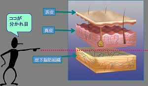 皮下組織説明図