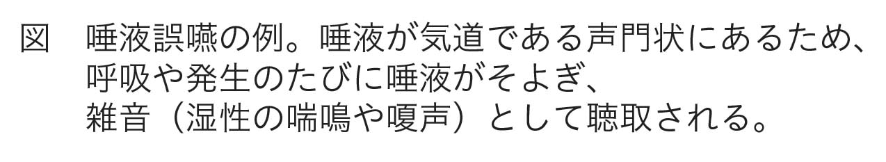 誤嚥説明写真②