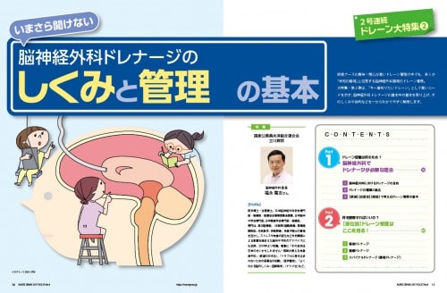 脳神経外科ドレナージのしくみと管理特集1ページ