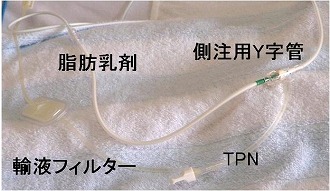 側注用Y字管から脂肪乳剤を投与している写真