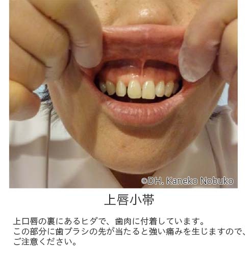 口唇小帯
