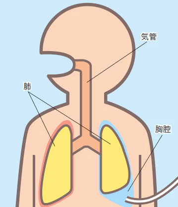 液体を排出する場合の図