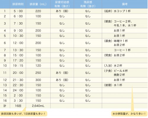 過剰な飲水摂取による頻尿