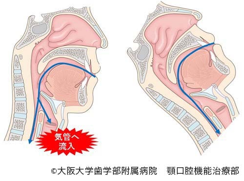 リクライニング位における嚥下解説図