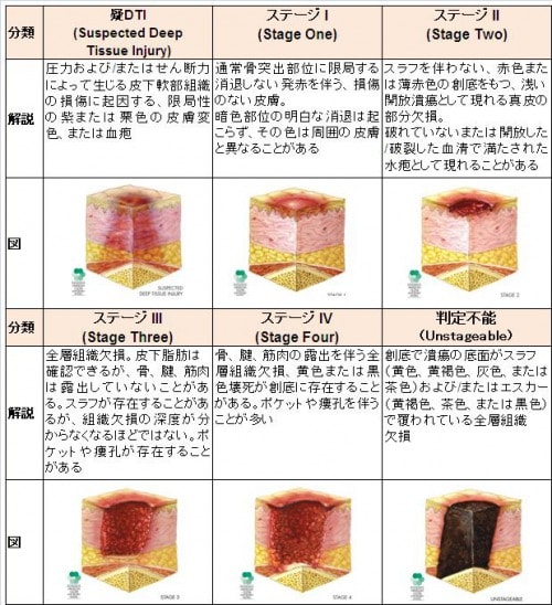 米国のNPUAPの褥瘡分類について説明図