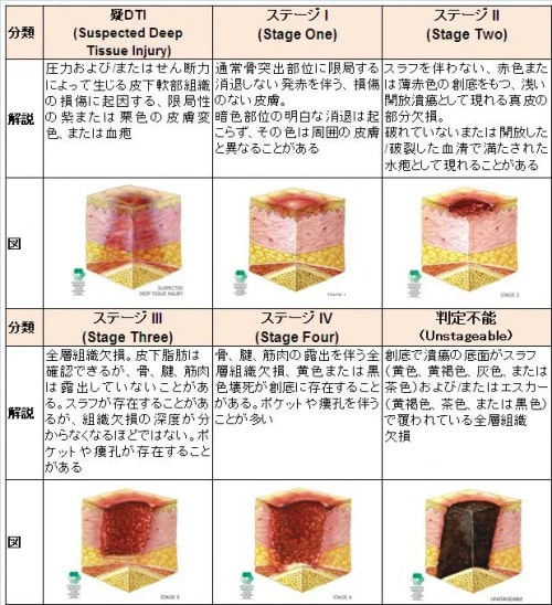 米国のNPUAPの褥瘡分類について説明図