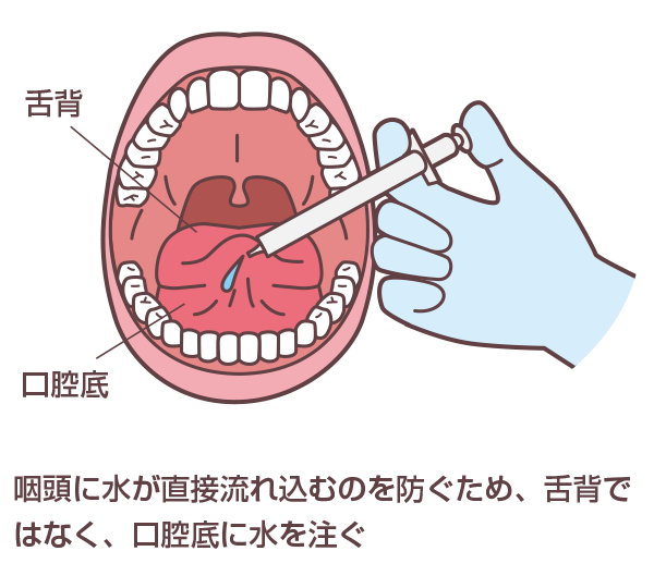 改訂水飲みテスト