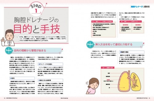 胸腔ドレナージの目的と手技