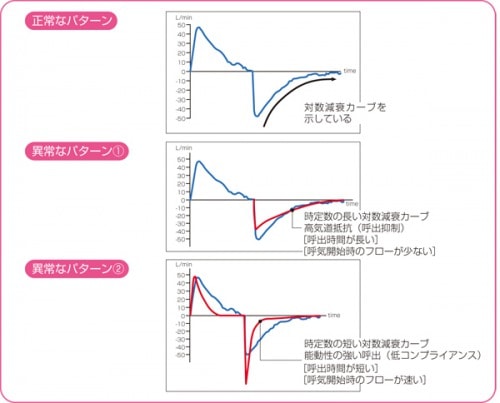 呼気フローの正常と異常なパターン