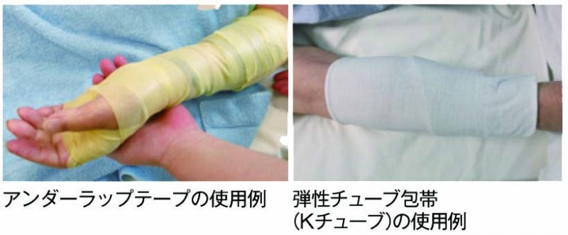 アンダーラップテープ、弾性チューブ包帯の使用例