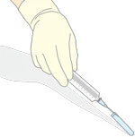 リキャップ立ての使用例