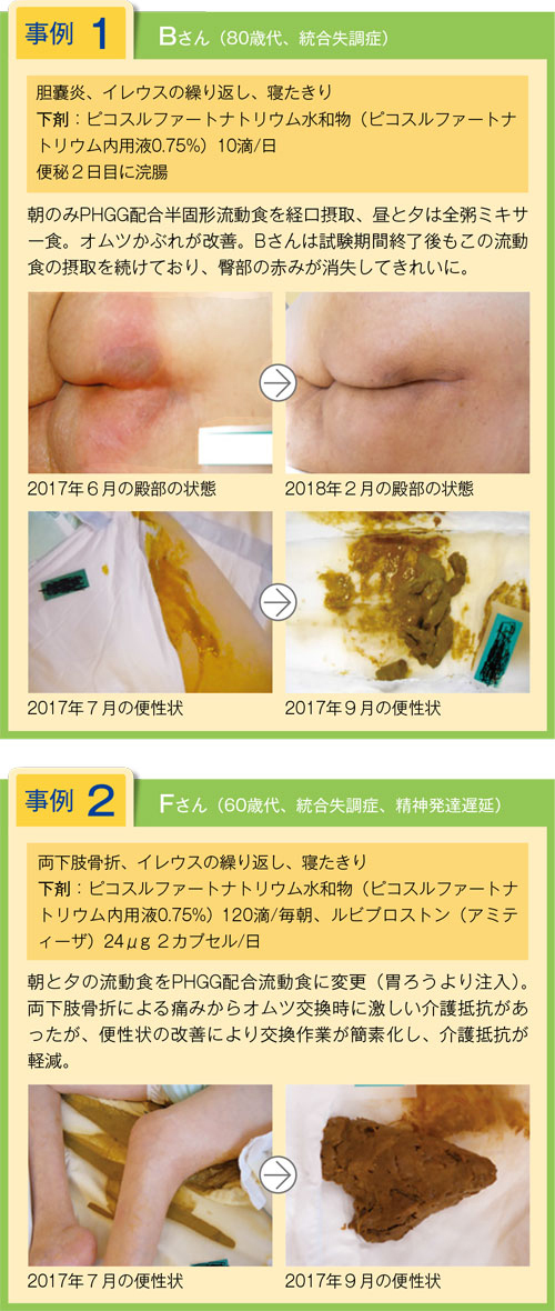 事例
