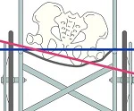 座面のたわみによる傾き