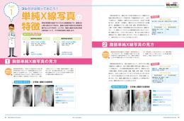 ナース専科2015年8月号『がん患者さんを感染から守る!』内容③