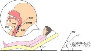 嚥下困難時のギャッジアップ
