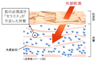バリア機能が低下して、乾燥し、潤いが失われた状態