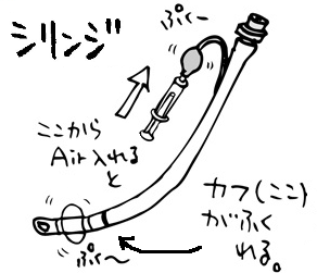 気管挿管に必要なカフ用シリンジ