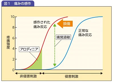 図1痛みの感作の図