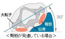 臀筋が発達している場合