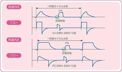 SIMV(+PS)の設定項目