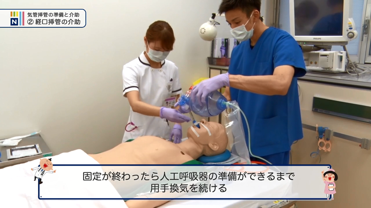 15.固定が終わったら人工呼吸器の準備ができるまで用手換気を続ける