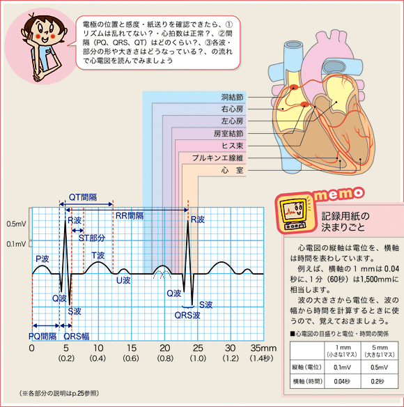 心電図判読のポイントまとめ表②