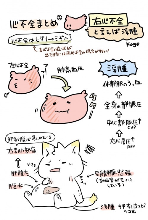 心不全についての説明図(右心不全)