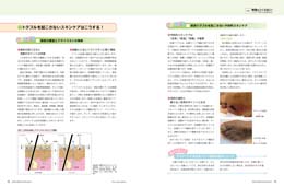 ナース専科2014年7月号『褥瘡をつくらない!』内容②
