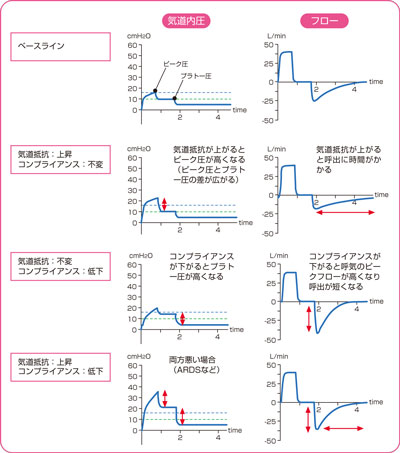 圧の上昇とフローの変化説明図