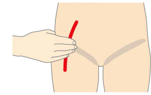 大腿動脈