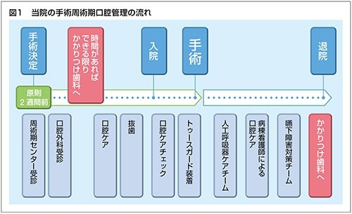 周術期口腔管理の流れ