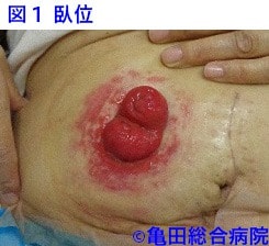 臥位の写真