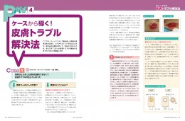 ナース専科2015年10月号『スキンケアの誤解』内容1ページ③