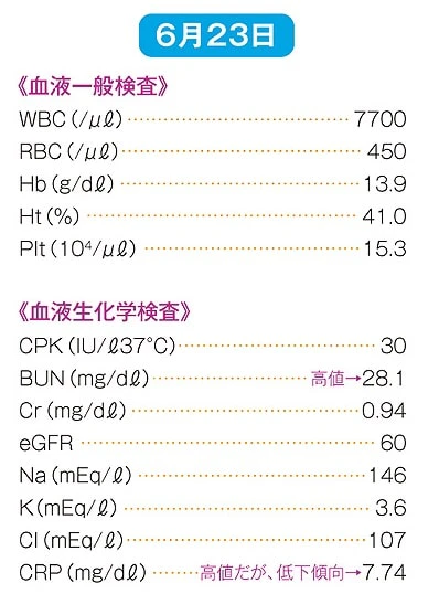 検査値の推移(6月23日)