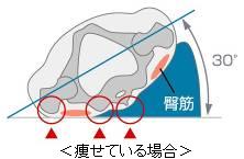 やせている場合