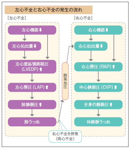 左心不全と右心不全の発生の流れ
