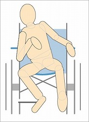 褥瘡治療の前に褥瘡発生の原因イメージ図