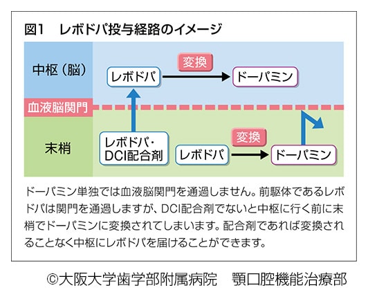 レボドパ投与経路のイメージ説明図