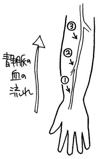点滴で血管が長く見えるときは末端から刺す