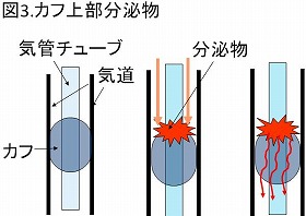 カフ上部分泌物説明図