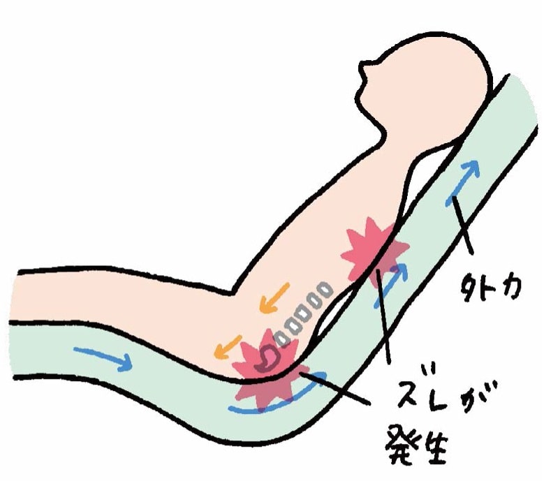 動的外力のかかり方(背上げ時)