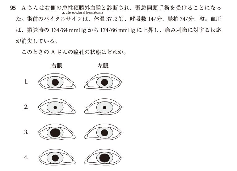 採点除外や不適当問題などはどれ? 取り扱いは?