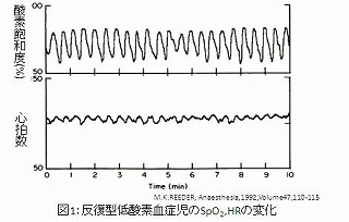 反復型低酸素血症児のSpO2HRの変化