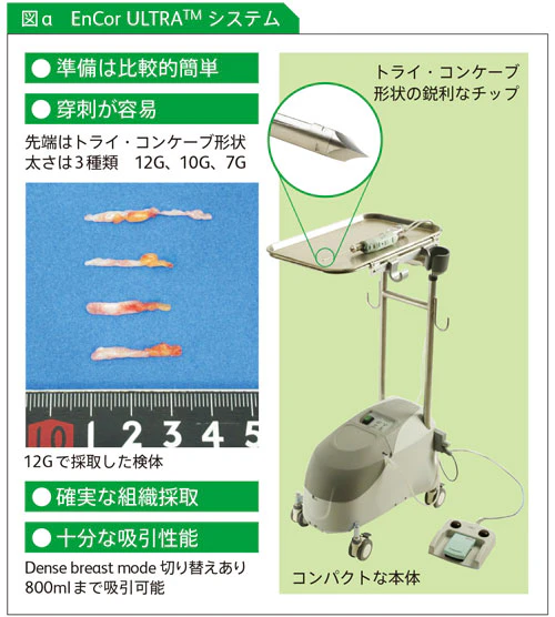 EnCorULTRAシステム