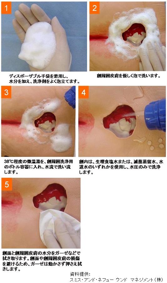 創洗浄の具体的な方法