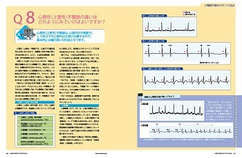 心電図の読み方のコツQ&Aの特集1ページ