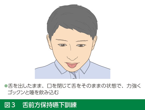 fig3