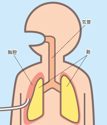 気体を排出する場合の図